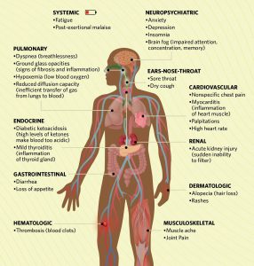 The Scientist article and diagram